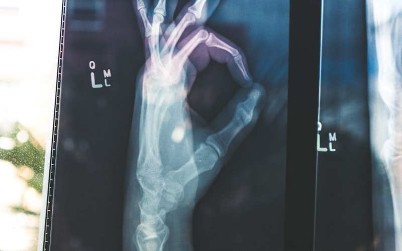 Ankle Impingement Treatment